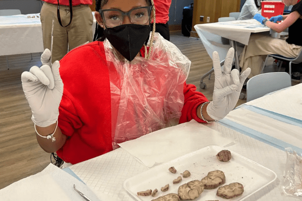 Neuro S1 Sanayah Selli Dissection AB min