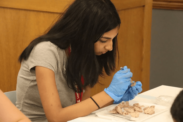 Neuro S1 Vaanya Modalla Dissection AB min