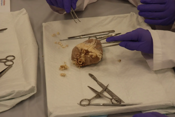 S4_Dissection