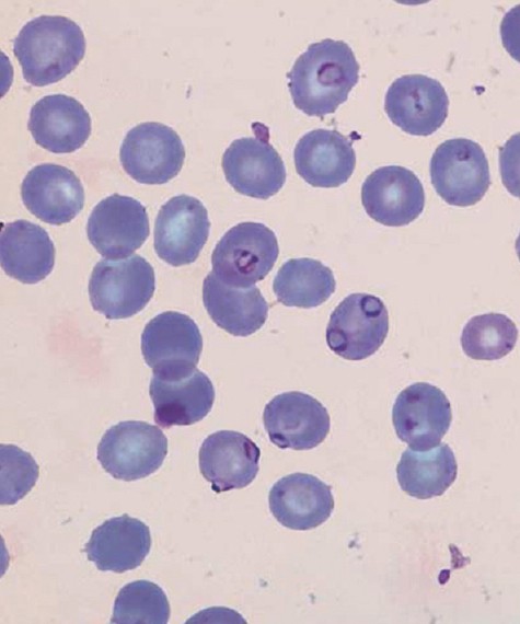 Ryan Reynolds - Wade / Deadpool